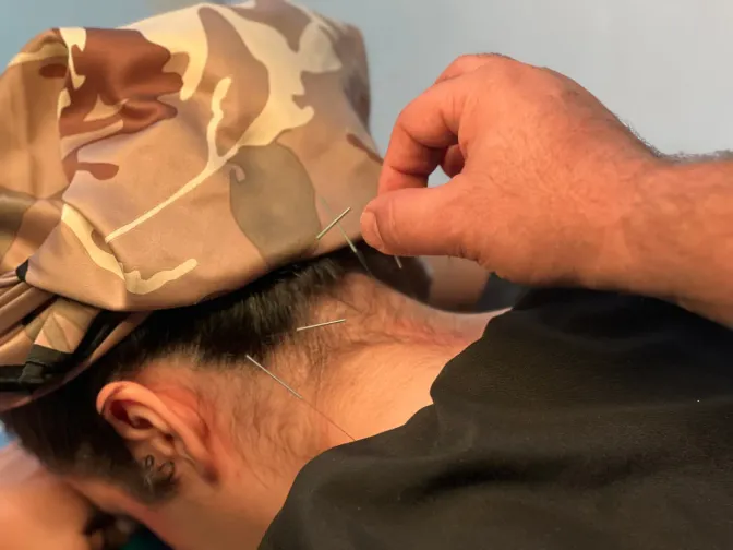 سوزن خشک در ناحیه گردن